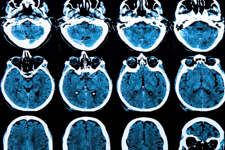 Slovem roku je podle vědců z Oxfordu 